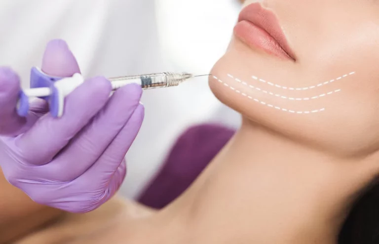 Kybella Treatment: The Revolutionary Solution for Double Chin Reduction