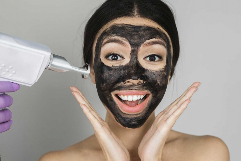 Benefits of Carbon Peel Laser for Clear and Radiant Skin