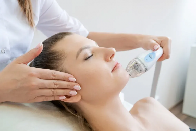 Microneedling for Melasma: Can It Help Reduce Pigmentation?