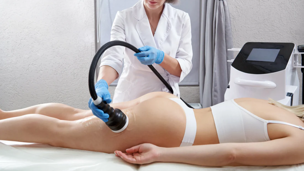 Lipo Cavitation Results Last