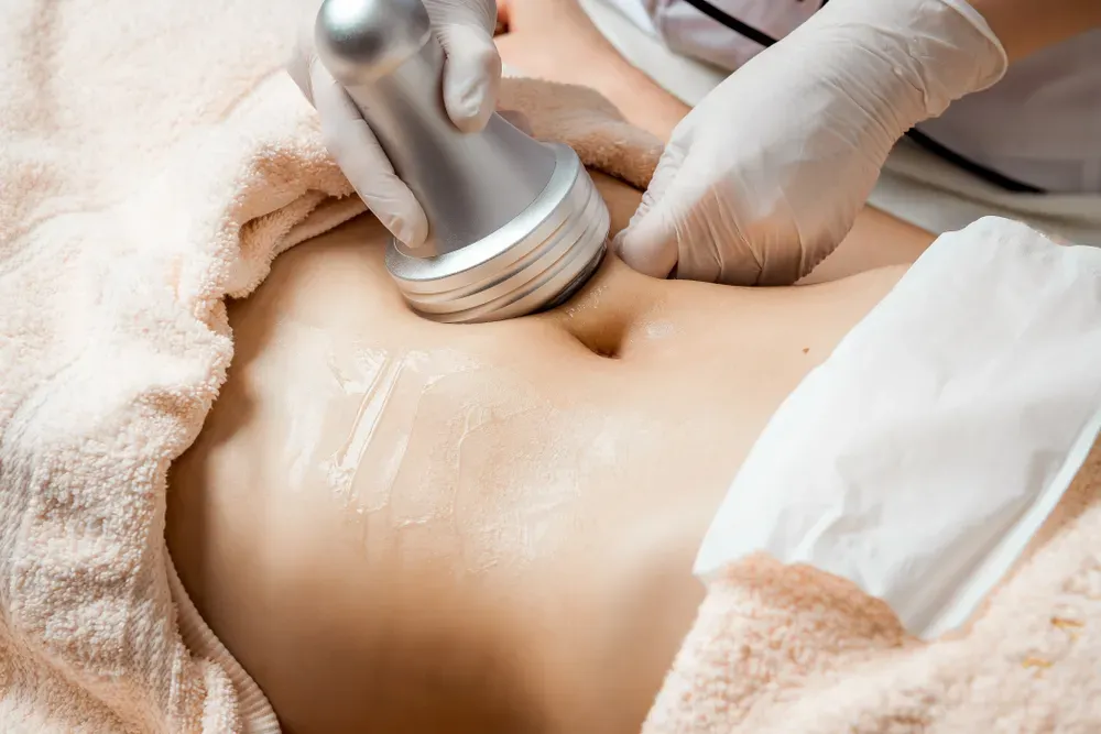 What Is Lipo Cavitation