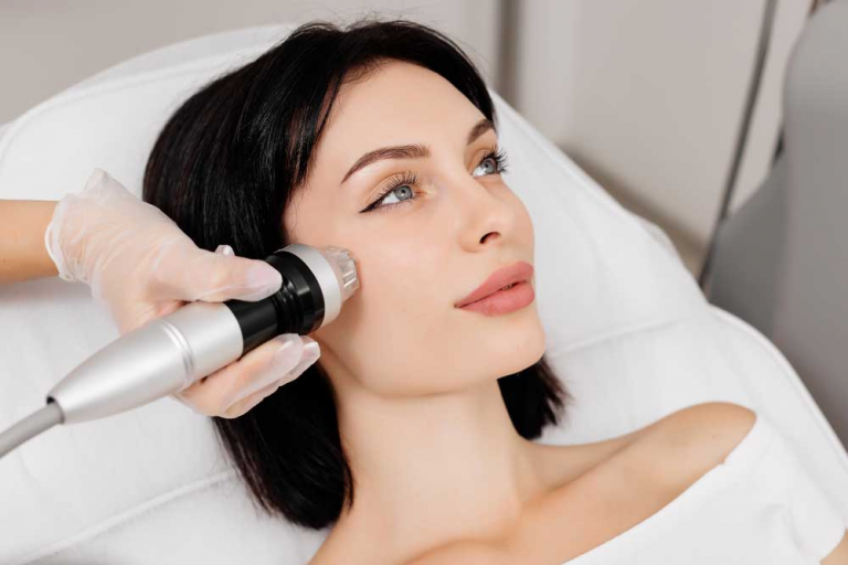 Microneedling RF: A Revolutionary Anti-Aging Treatment for Radiant, Firm Skin
