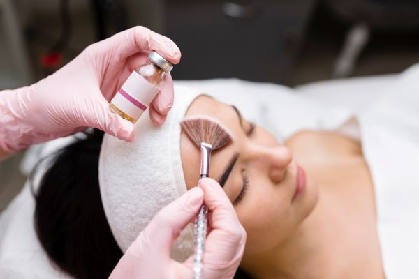 Chemical Peel