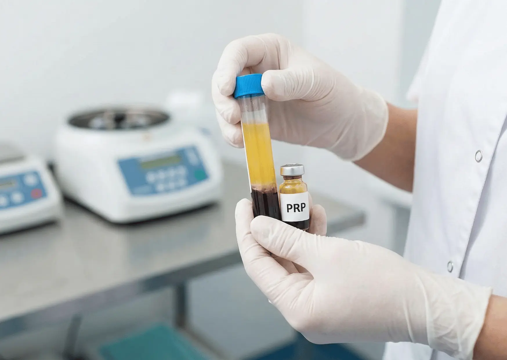 PRP preparation process using centrifuge at Arizona Medlaser clinic