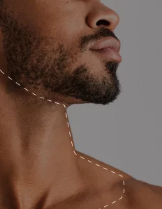 Male beard and neck laser hair removal area